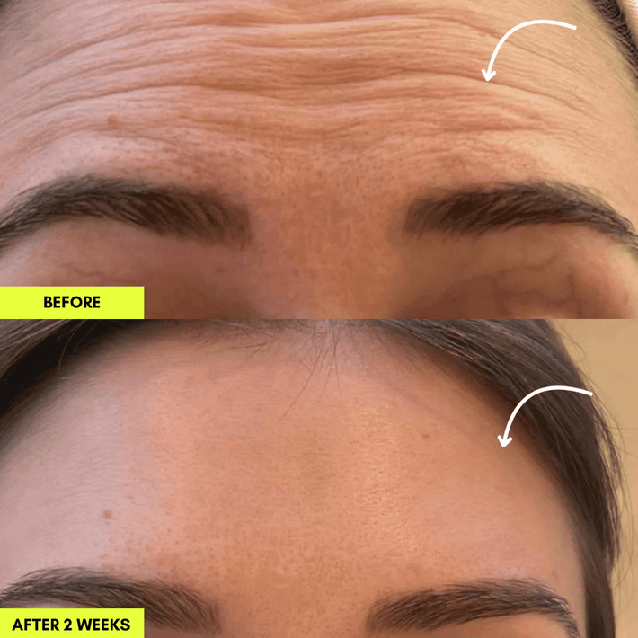 LumiSculpt™ Lymphatic Face Brush — De-Puff, Define & Glow Naturally