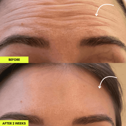 LumiSculpt™ Lymphatic Face Brush — De-Puff, Define & Glow Naturally