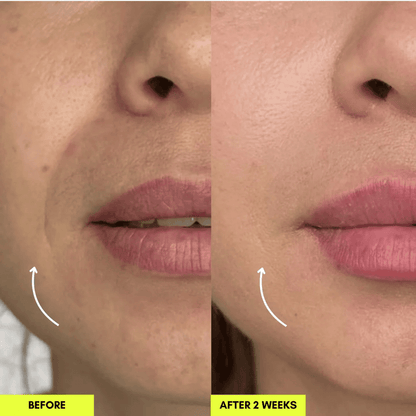 LumiSculpt™ Lymphatic Face Brush — De-Puff, Define & Glow Naturally