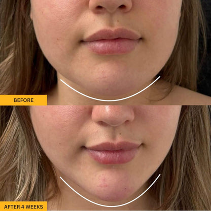 LumiSculpt™ Lymphatic Face Brush — De-Puff, Define & Glow Naturally